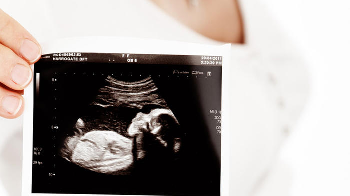 Für viele werdende Eltern eine willkommene Methode, vorab ihr ungeborenes Kind zu betrachten: Das „Baby-Watching".